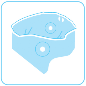 پاچ آرتروسکوپی